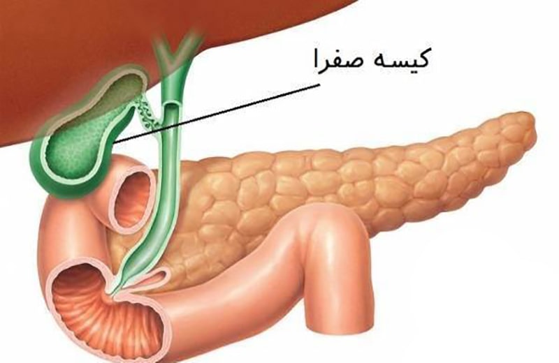 The best surgeon Gallbladder in North Tehran
