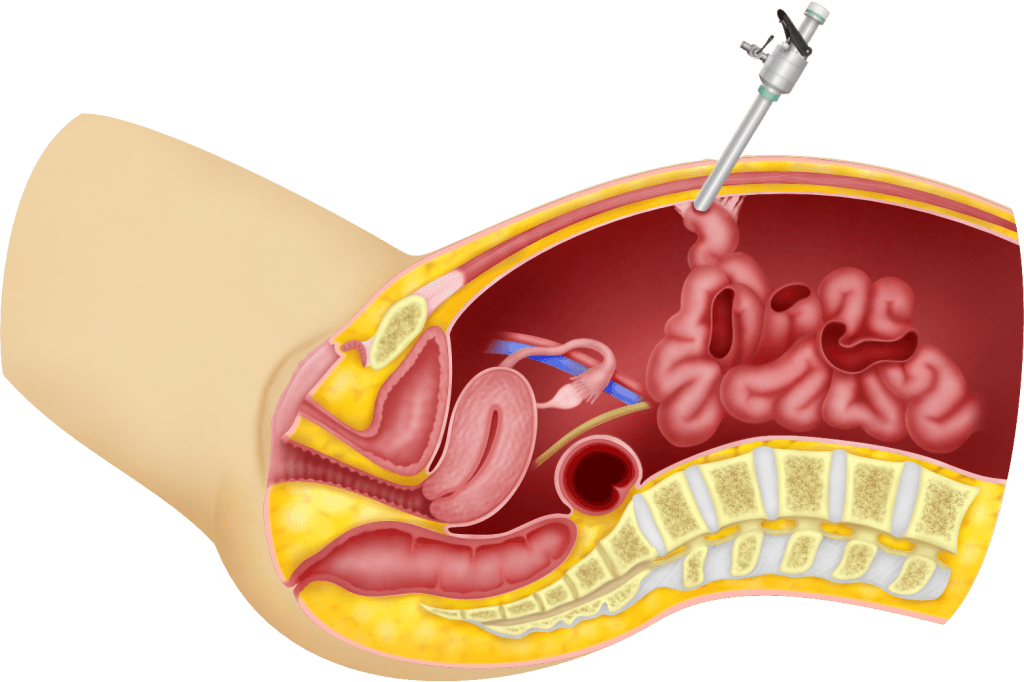 أفضل جراح مناظير في الشمال طهران
