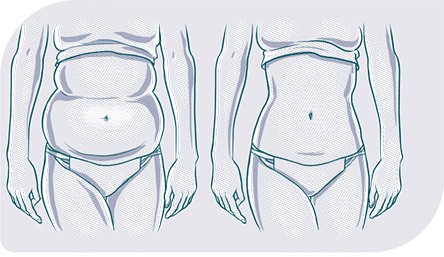 Lipomatic Surgery Center in North Tehran