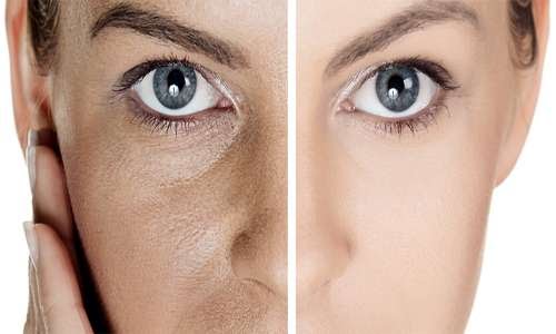 مركز العلاج بالكاربوكسي في ظفار