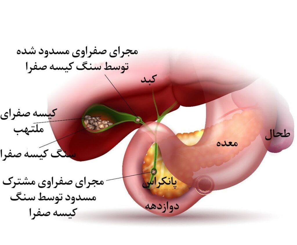 The best gallbladder surgeon in North Tehran