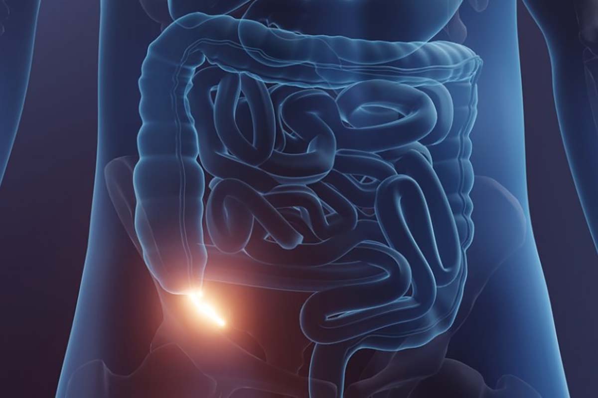 مركز جراحة الزائدة الدودية في ظفر