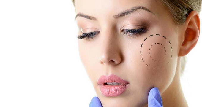 بهترین جراح گونه