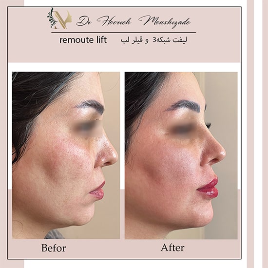 Untitled-12erger-min