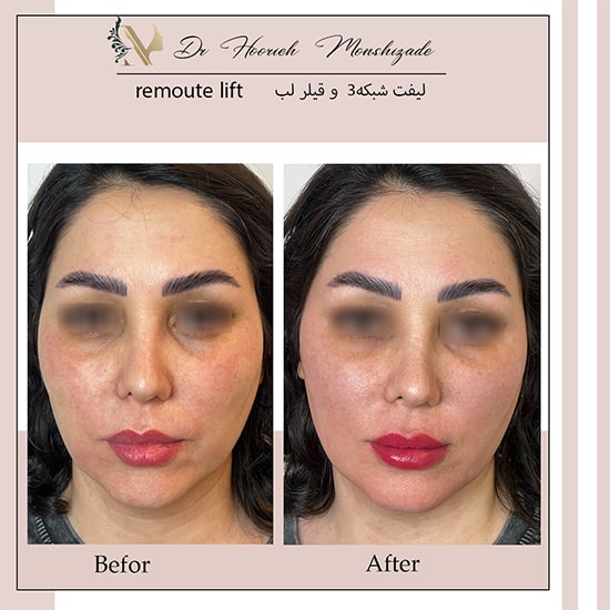 Untitled-14ergerg-min