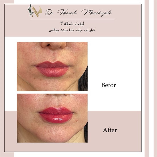 Untitled-15ergerg-min