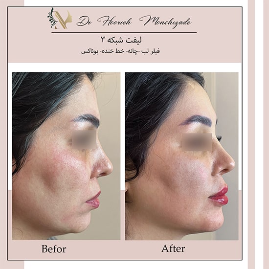 Untitled-16egerg-min