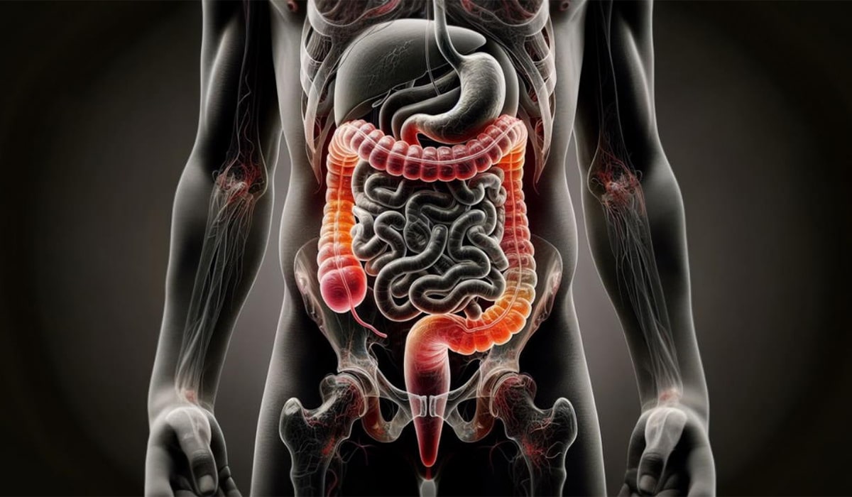 مركز جراحة الزائدة الدودية في ظفر