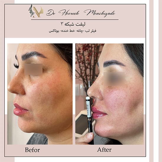 Untitled-17ergeg-min