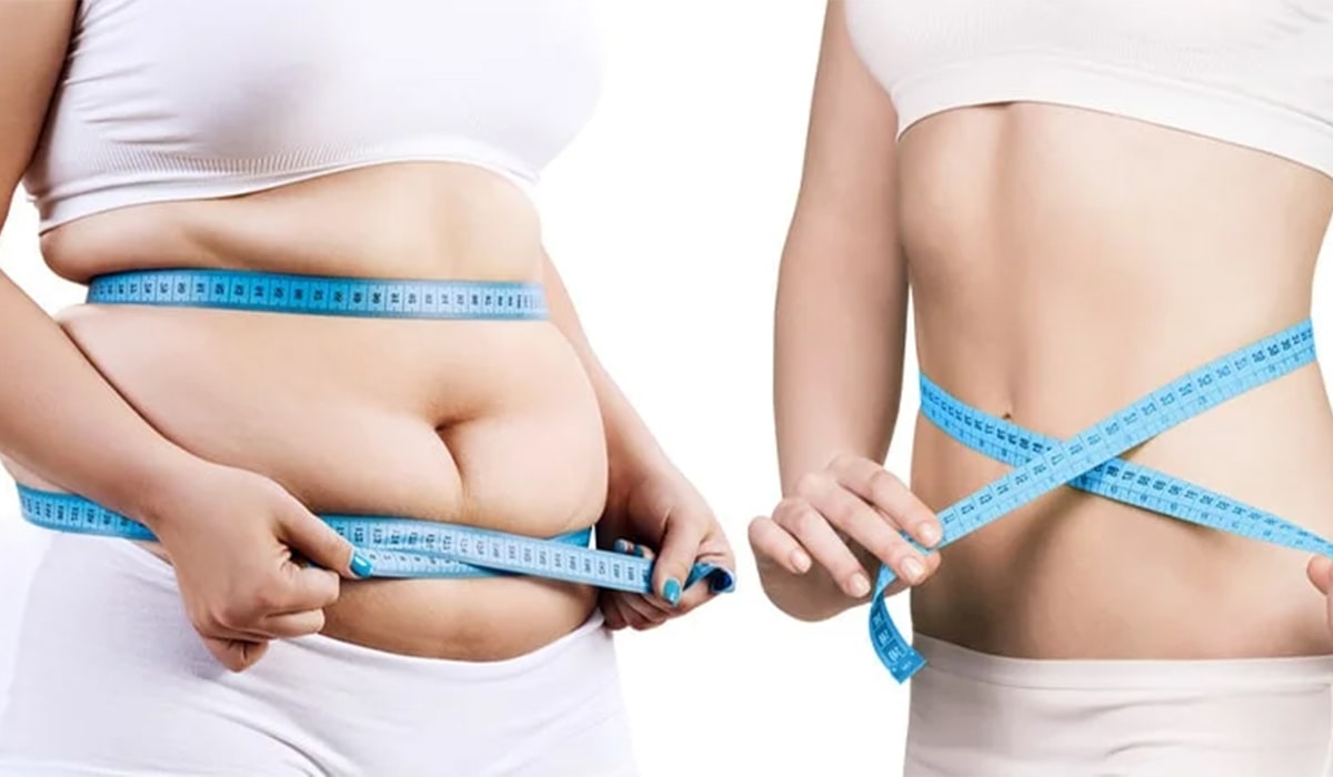 مرکز عمل لیپوماتیک در شمال تهران