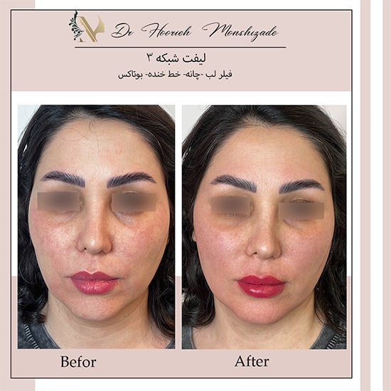 Untitled-19egerg-min