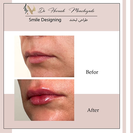 Untitled-1thtsrh-min