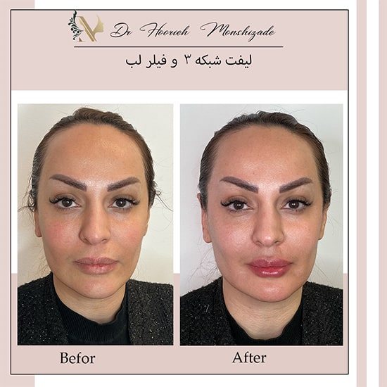 Untitled-24ergeg-min