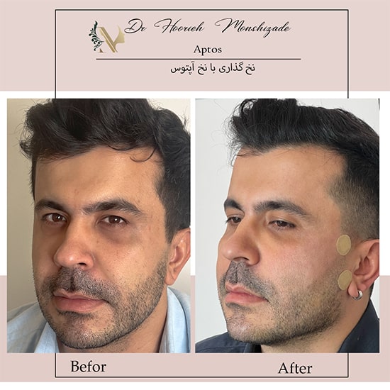 Untitled-26ergerg-min