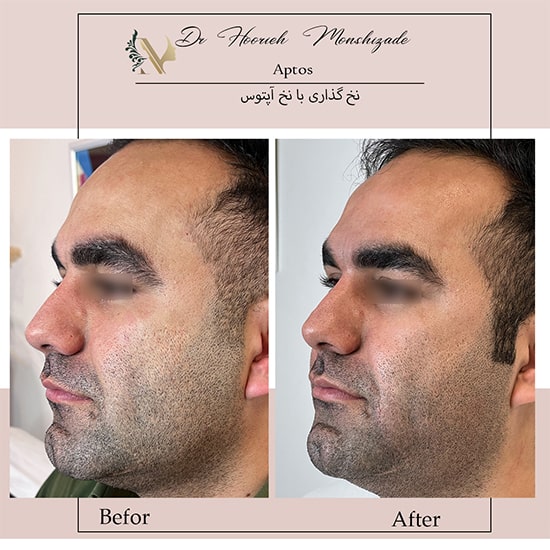 Untitled-28ergeg-min