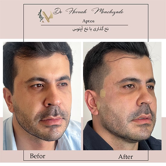 Untitled-29ergerg-min