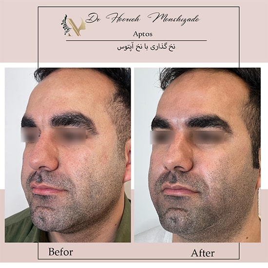 Untitled-30ergegreg-min