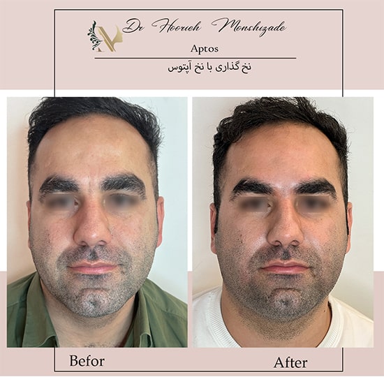 Untitled-33ergergerg-min