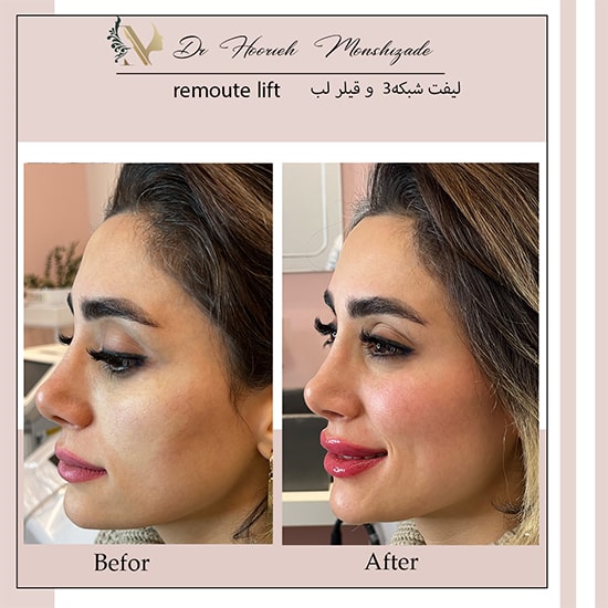 Untitled-34ergerg-min