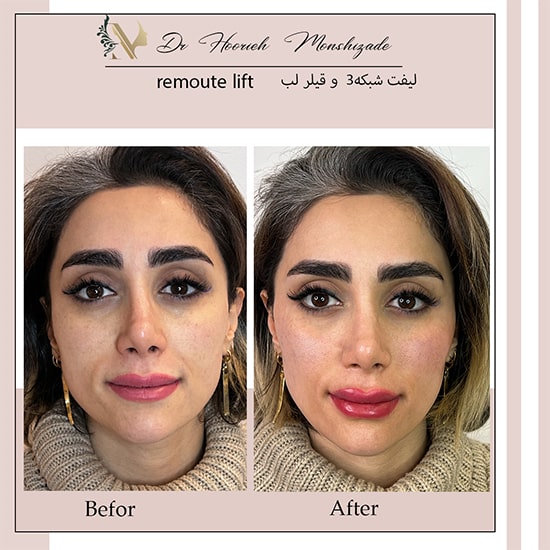 Untitled-36ergerg-min