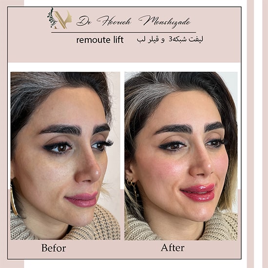 Untitled-37egerg-min