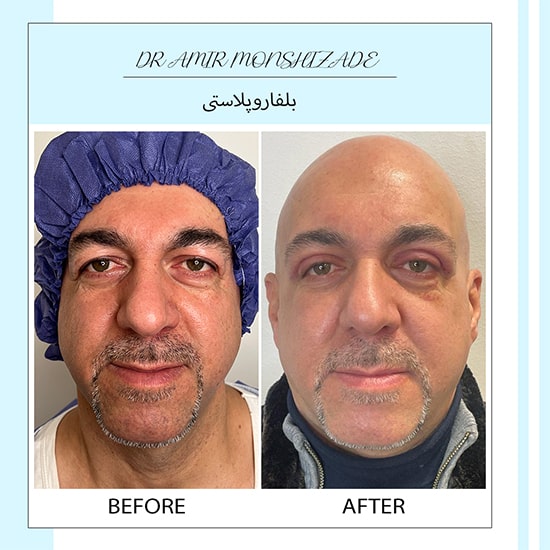 Untitled-3rtertert-min