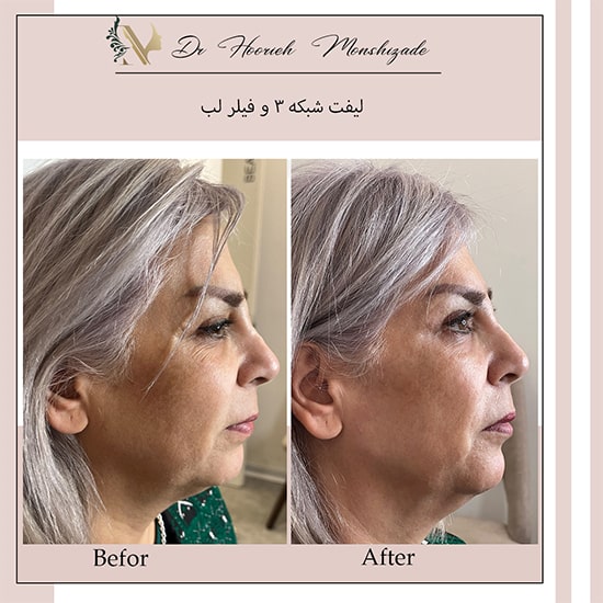 Untitled-4ertert-min