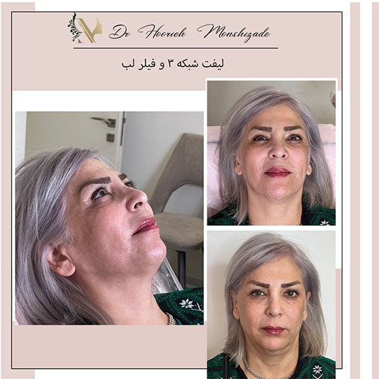 Untitled-5rthytrh-min