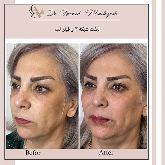 Untitled-6ergreg-min