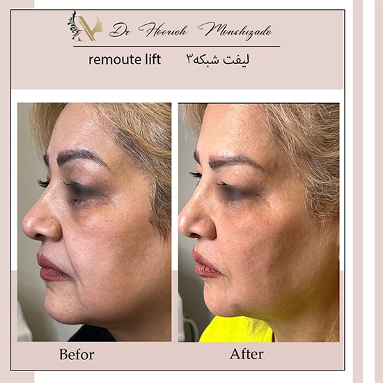 Untitled-6errrrrr-min