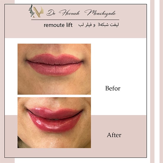 Untitled-7ergerg-min