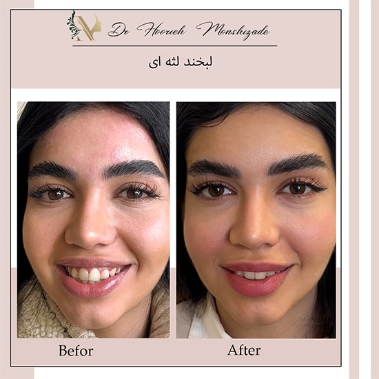 Untitled-7tttttttttt-min