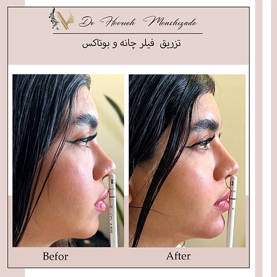 Untitled-8fffffff-min