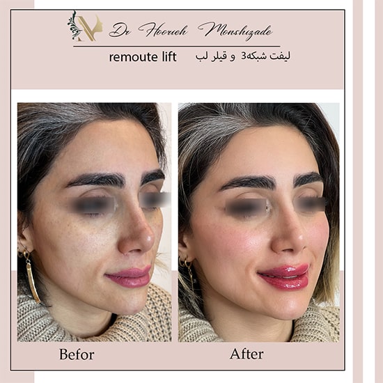 Untitled-9ergerg-min