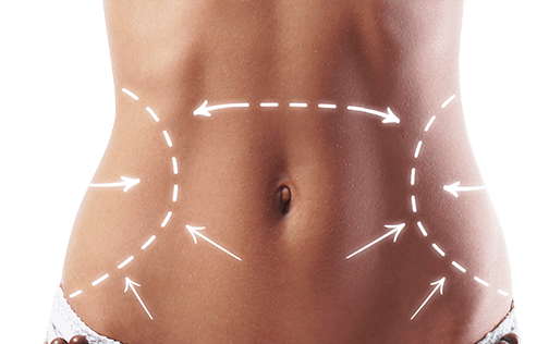 مرکز عمل لیپوماتیک در شمال تهران