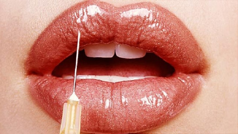 مرکز تزریق ژل زیبایی در شمال تهران