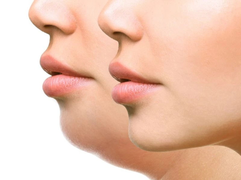 مرکز جراحی غبغب