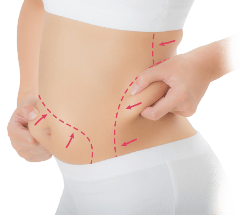 مرکز لیپوساکشن