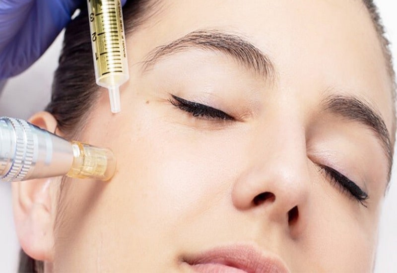 مرکز مزوتراپی مو در ظفر