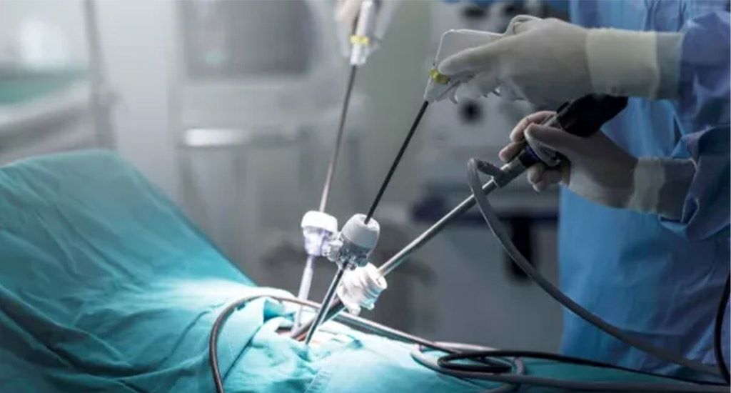 بهترین جراح لاپاراسکوپی