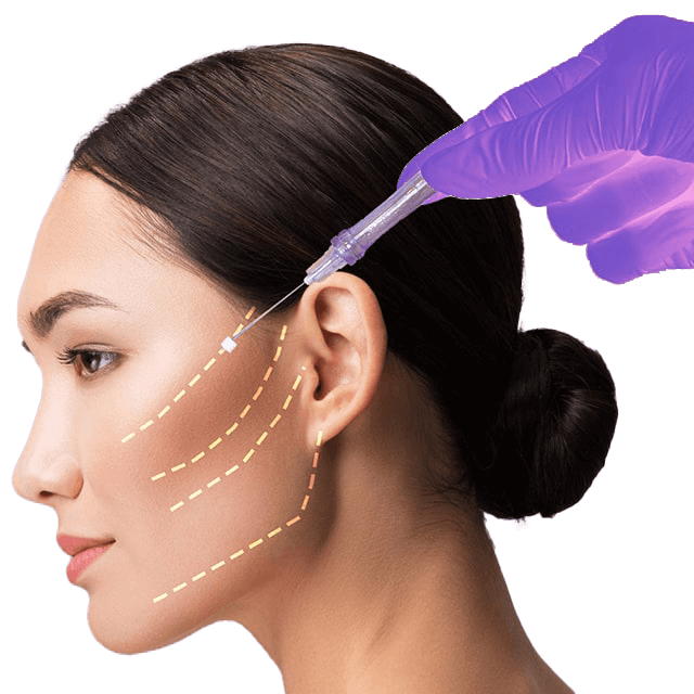 مرکز لیفت شبکه در ظفر