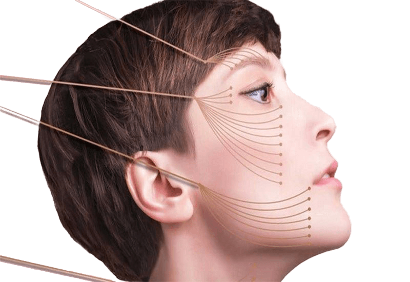 مرکز لیفت شبکه در ظفر