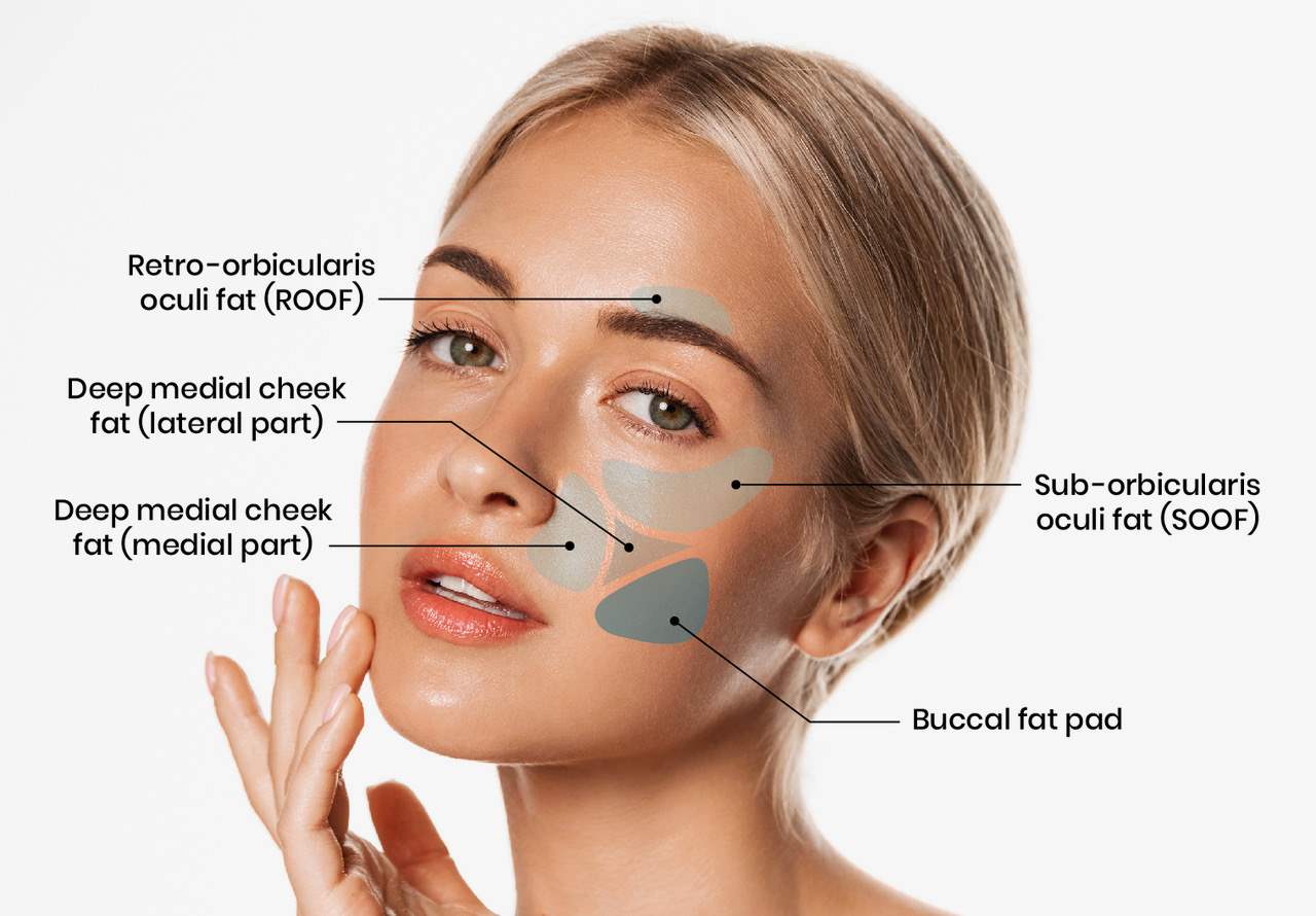 بهترین جراح چربی باکال در شمال تهران
