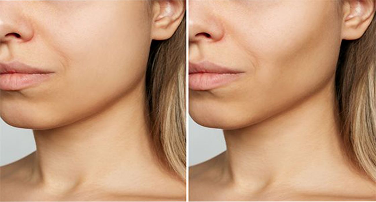 مرکز جراحی چربی باکال در ظفر