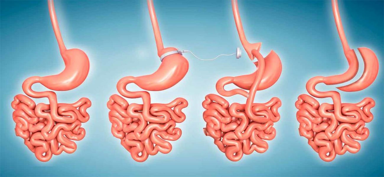 بهترین چاقی در شمال0 تهران