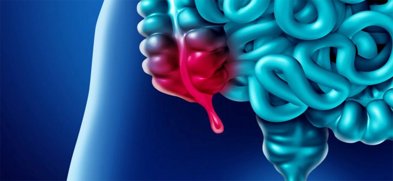 بهترین جراح آپاندیس